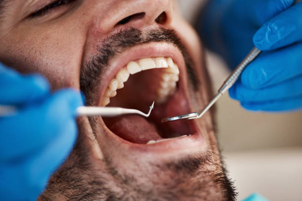 Best Weekend Emergency Dentist in Derma, MS